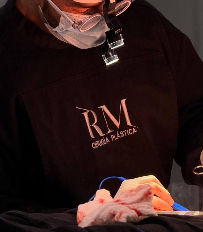 Rinoplastia